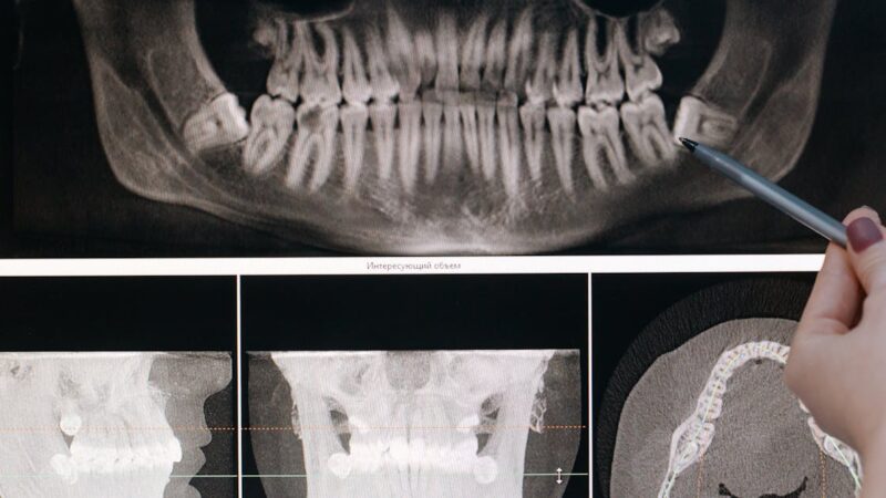 découverte de la citroën c5 x : l’élégance et la performance réunies